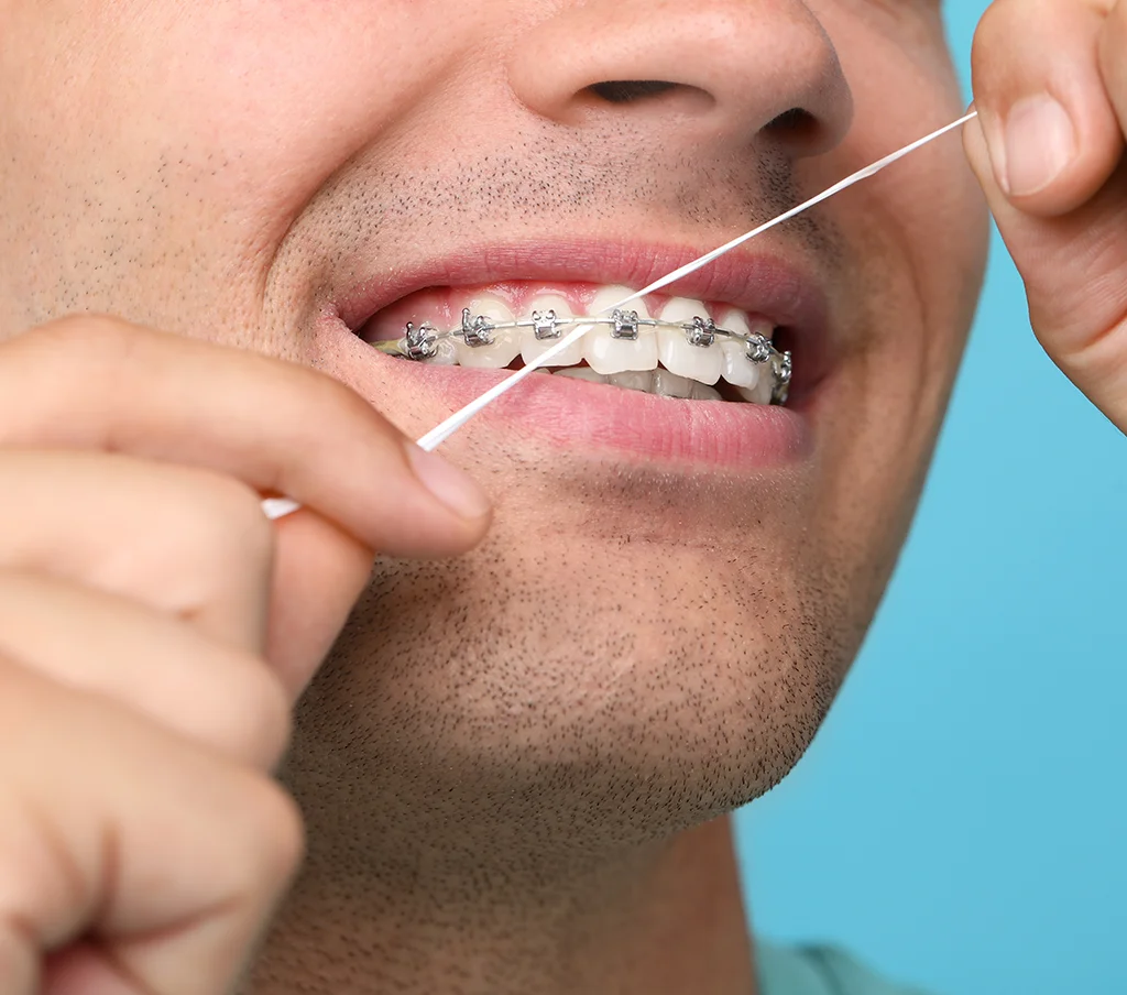 Flossing Information