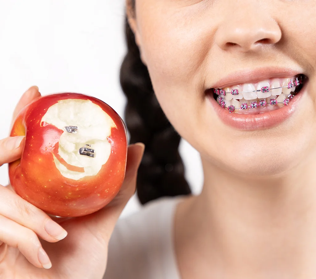 Food and Braces